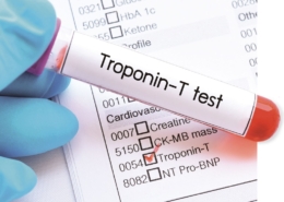 آزمایش troponin