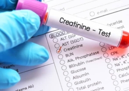 Creatinine
