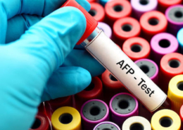 آلفا فتوپروتئین (AFP)